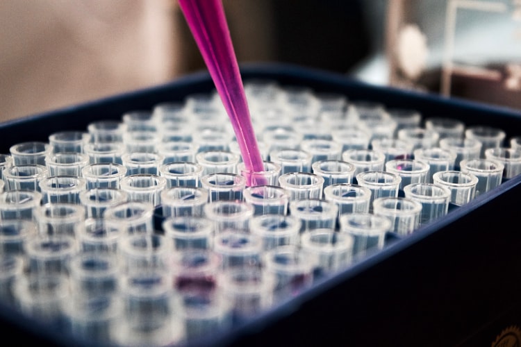 Pipeta roxa a encher tubos num laboratório para investigar tratamento de doenças e vírus, como a COVID-19