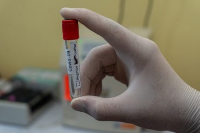 Teste de sangue para saber se tem ou teve COVID-19 e perceber a imunidade da população